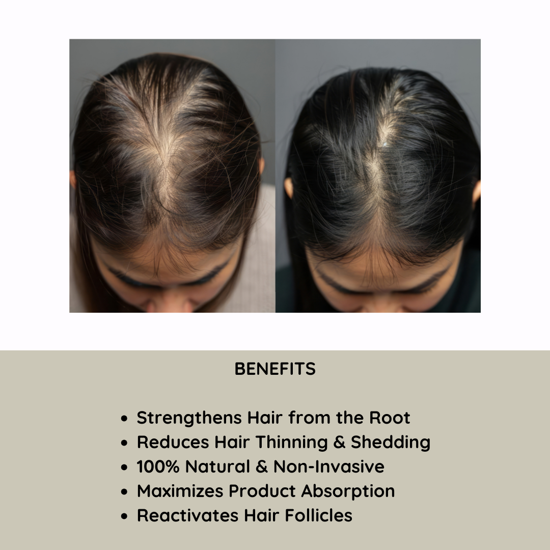 Microneedling Hair Growth Roller